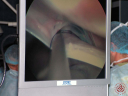 2008